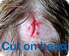 head cut bleeding