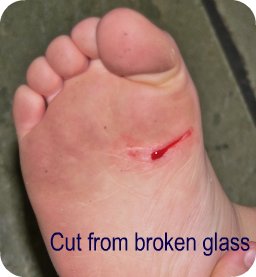 cut on foot